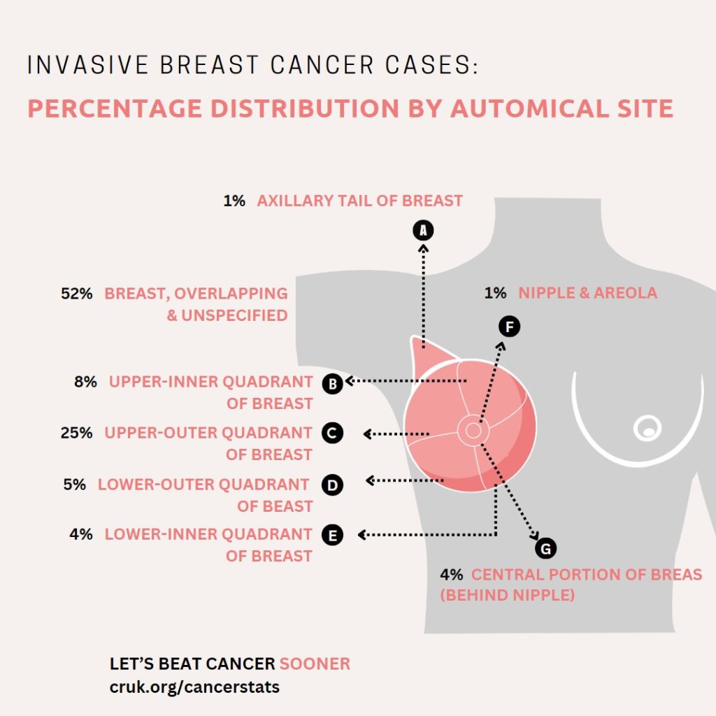 breast cancer and artificial intelligence